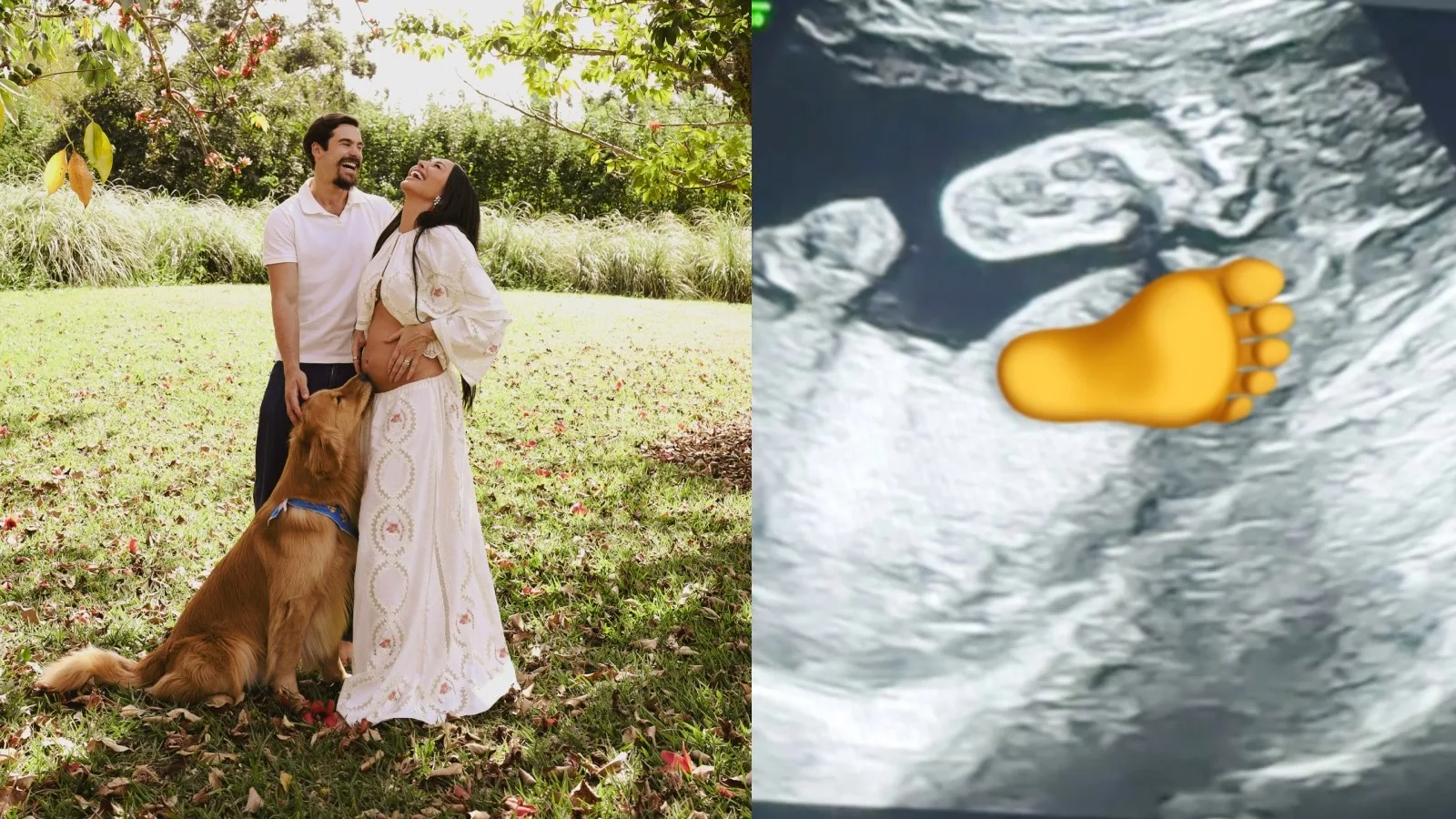 Nicolas Prattes compartilha ultrassom do filho com Sabrina Sato