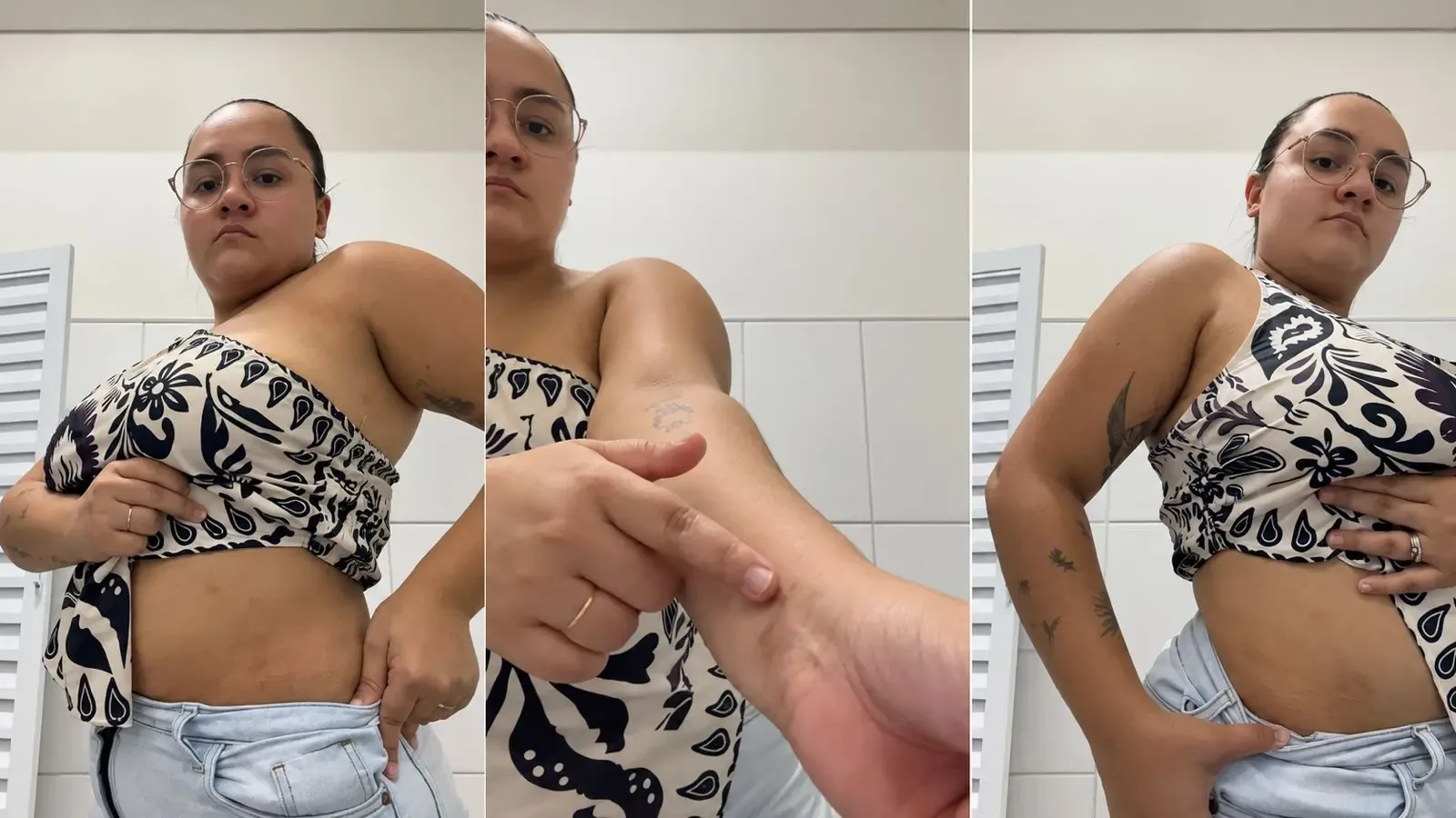 Psoríase afeta autoestima e pode levar ao isolamento social