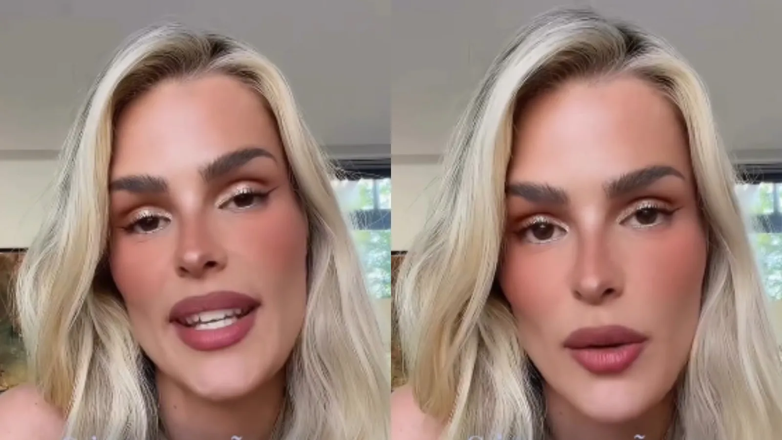 Yasmin Brunet relata episódios de depressão e fala sobre cuidados no tratamento