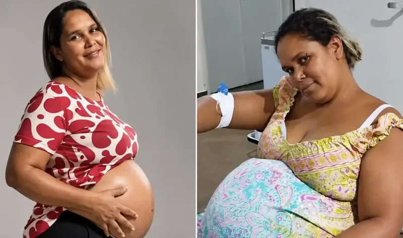 Morre segundo bebê de gestante que morreu após cesariana de emergência
