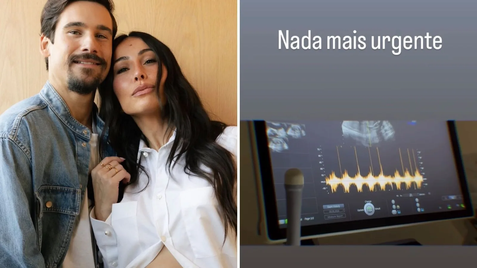 Nicolas Prattes se emociona ao ouvir batimentos do filho durante consulta