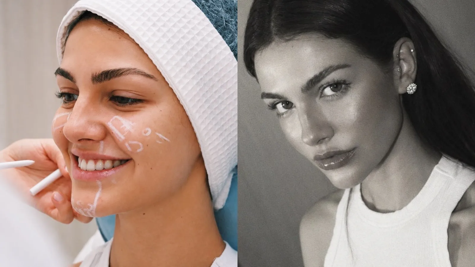Vitória Bohn mostra resultado de harmonização facial e recebe reação de Caio Castro