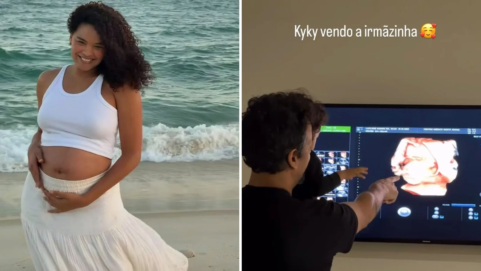 Lucy Ramos revela imagem de Kora em ultrassom 3D