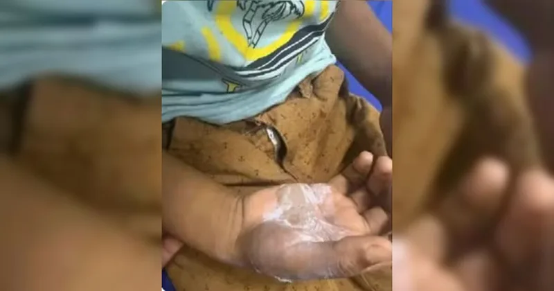 Mulher é presa suspeita de queimar filho de sete anos em Goiás
