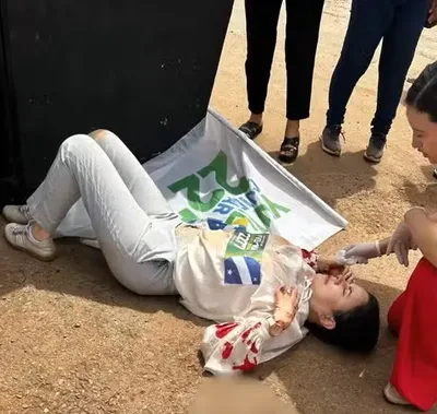 Maria Yvelonia segue internada após acidente com trio elétrico em Goiás