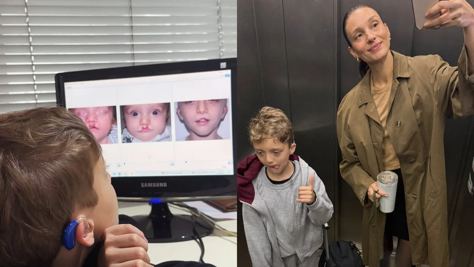 Isabel Hickmann mostra evolução do filho após cirurgias na infância