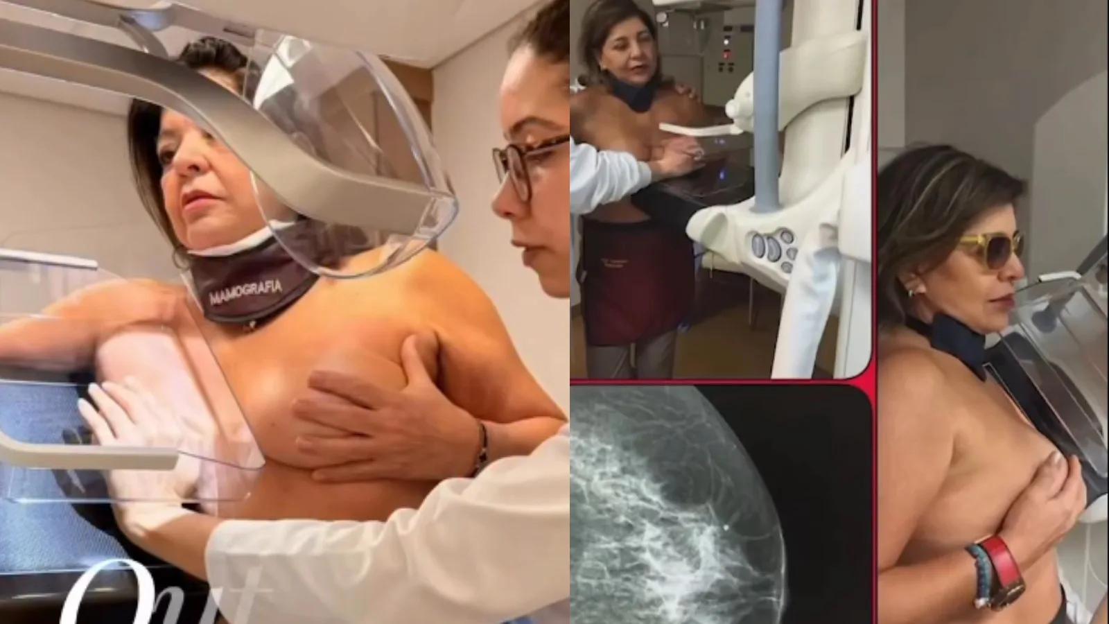 Roberta Miranda faz mamografia e reforça alerta sobre câncer de mama